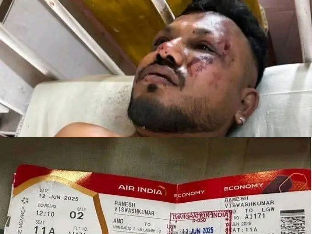 अहमदाबाद विमान दुर्घटनामा एक व्यक्तिको जीवितै उद्धार